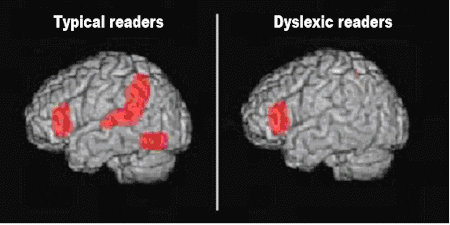 Brain Scan